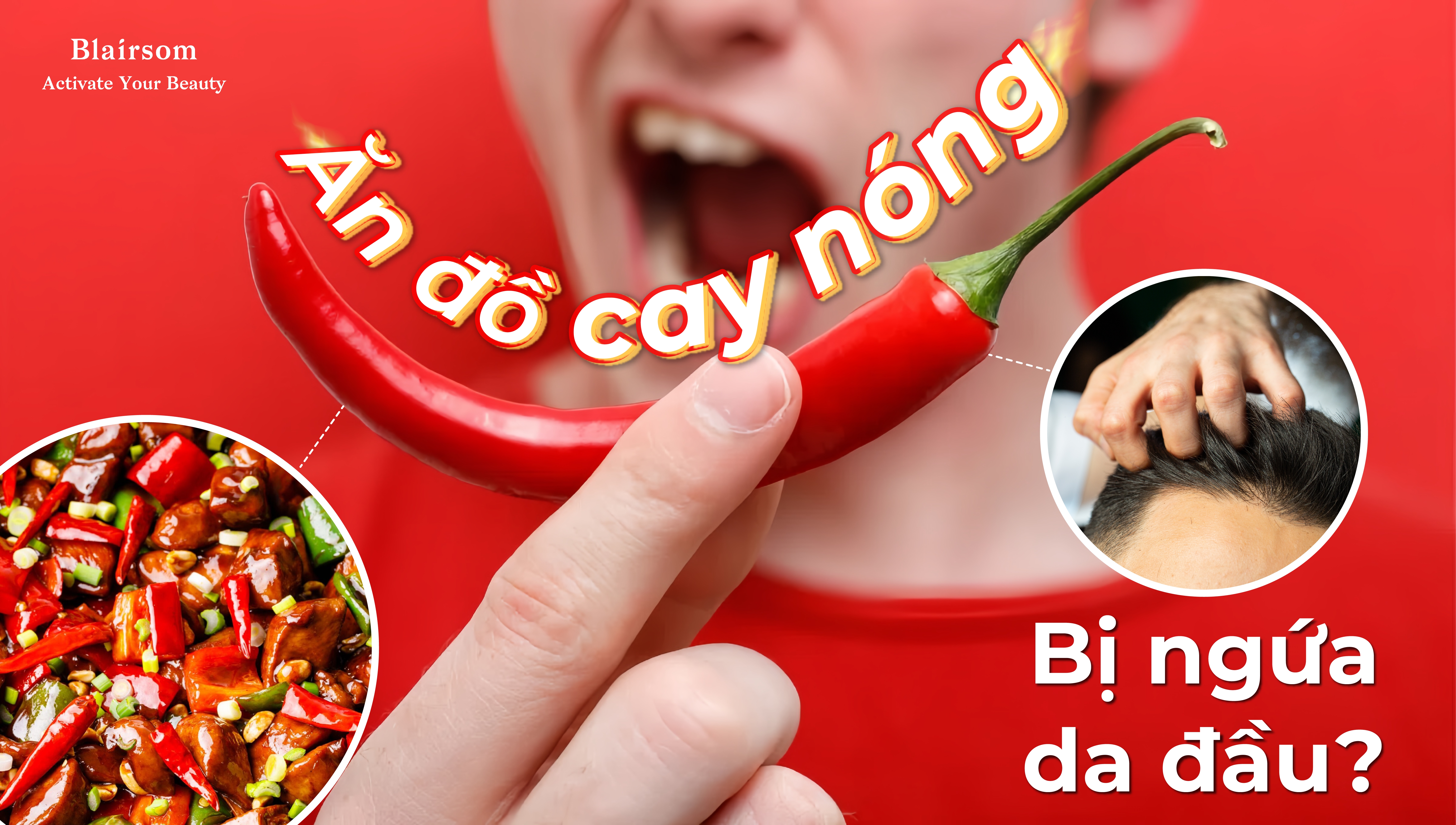 VÌ SAO ĂN CAY LẠI BỊ NGỨA DA ĐẦU?