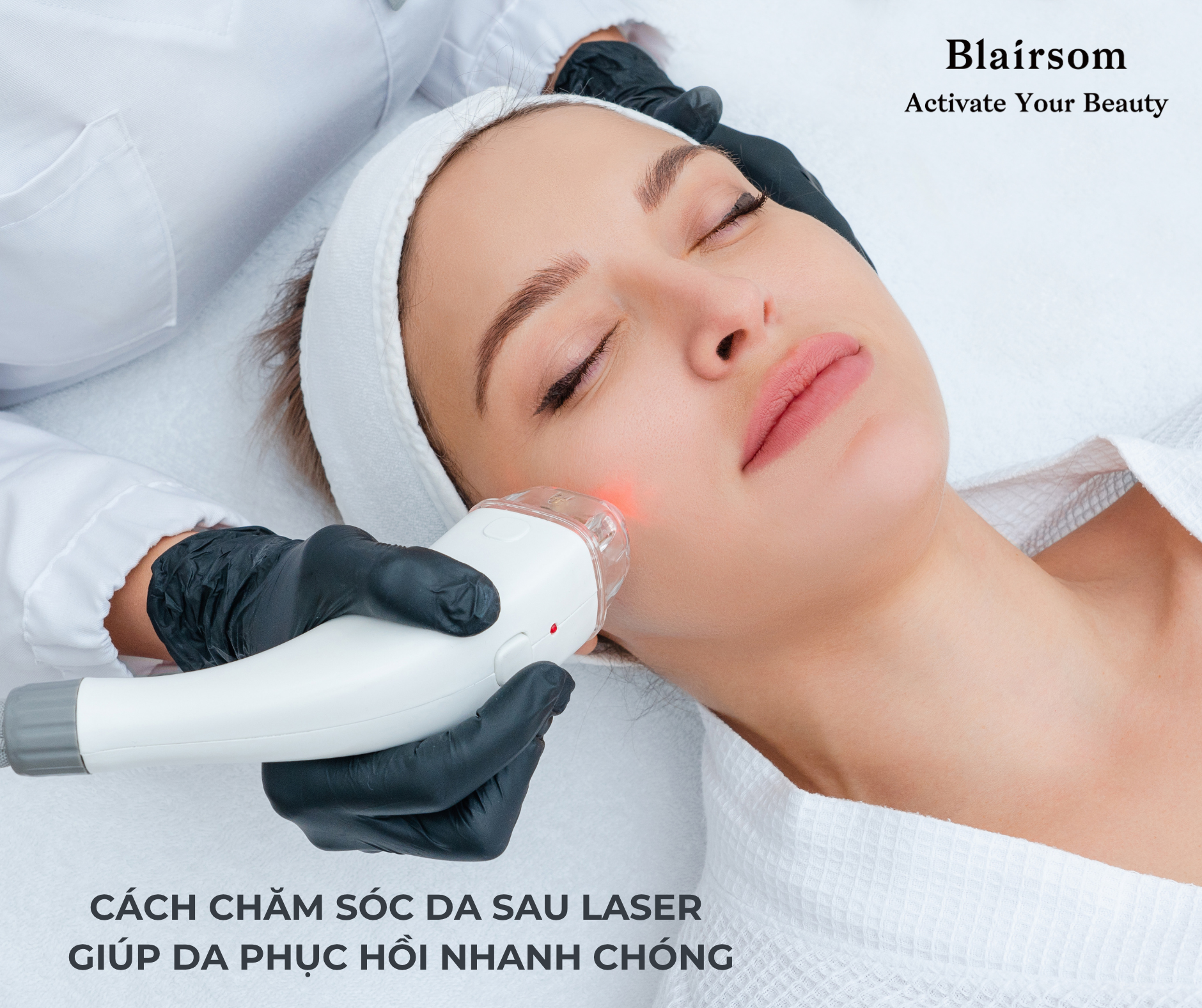 💦 CÁCH CHĂM SÓC DA SAU LASER GIÚP DA PHỤC HỒI NHANH CHÓNG