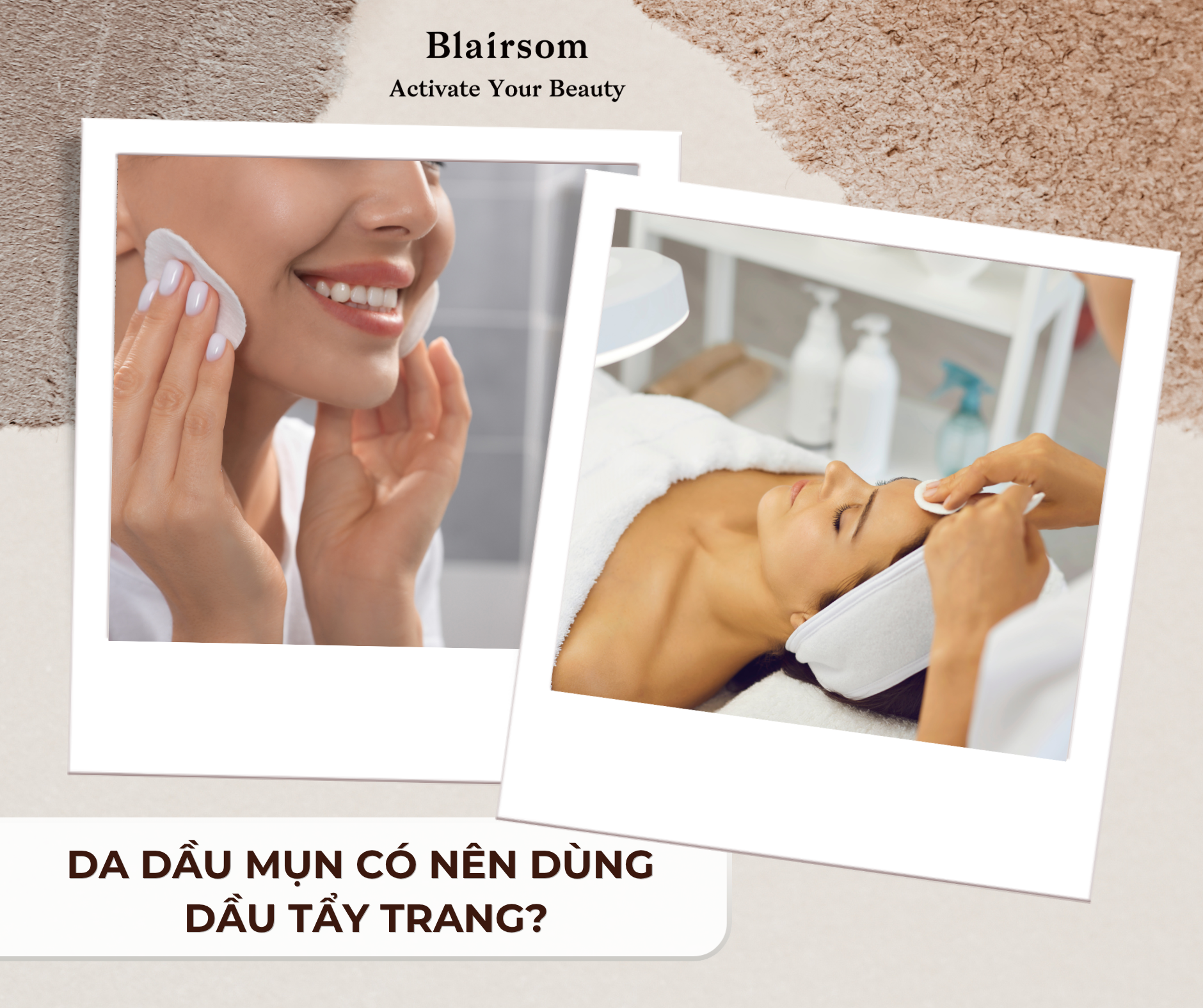 💁 DA DẦU MỤN CÓ NÊN DÙNG DẦU TẨY TRANG ?