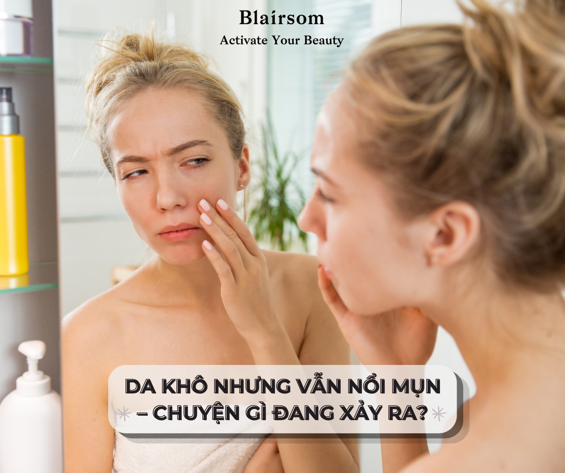 💁 DA KHÔ NHƯNG VẪN NỔI MỤN - CHUYỆN GÌ ĐÃ XẢY RA?