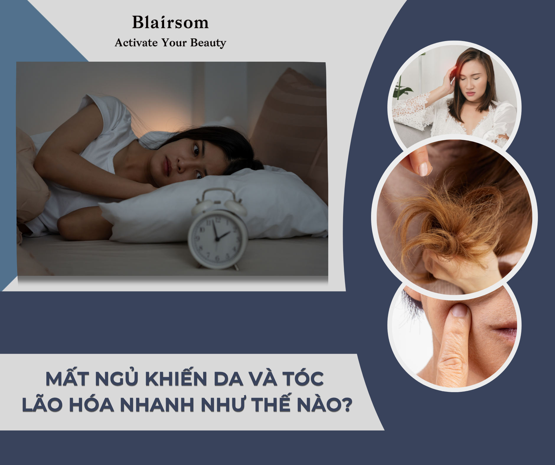 MẤT NGỦ KHIẾN DA VÀ TÓC LÃO HÓA NHANH NHƯ THẾ NÀO ?