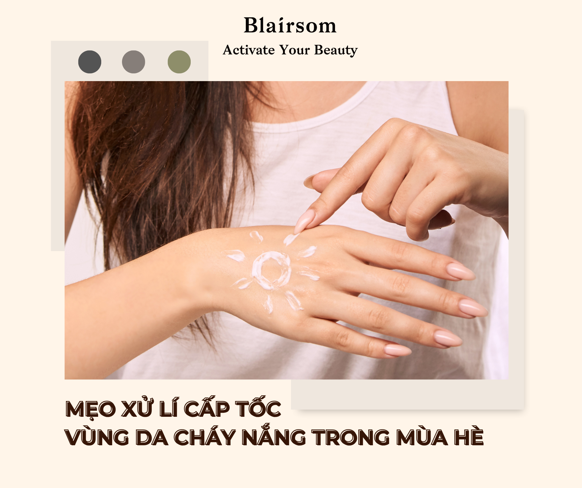 MẸO XỬ LÝ CẤP TỐC VÙNG DA CHÁY NẮNG TRONG MÙA HÈ 