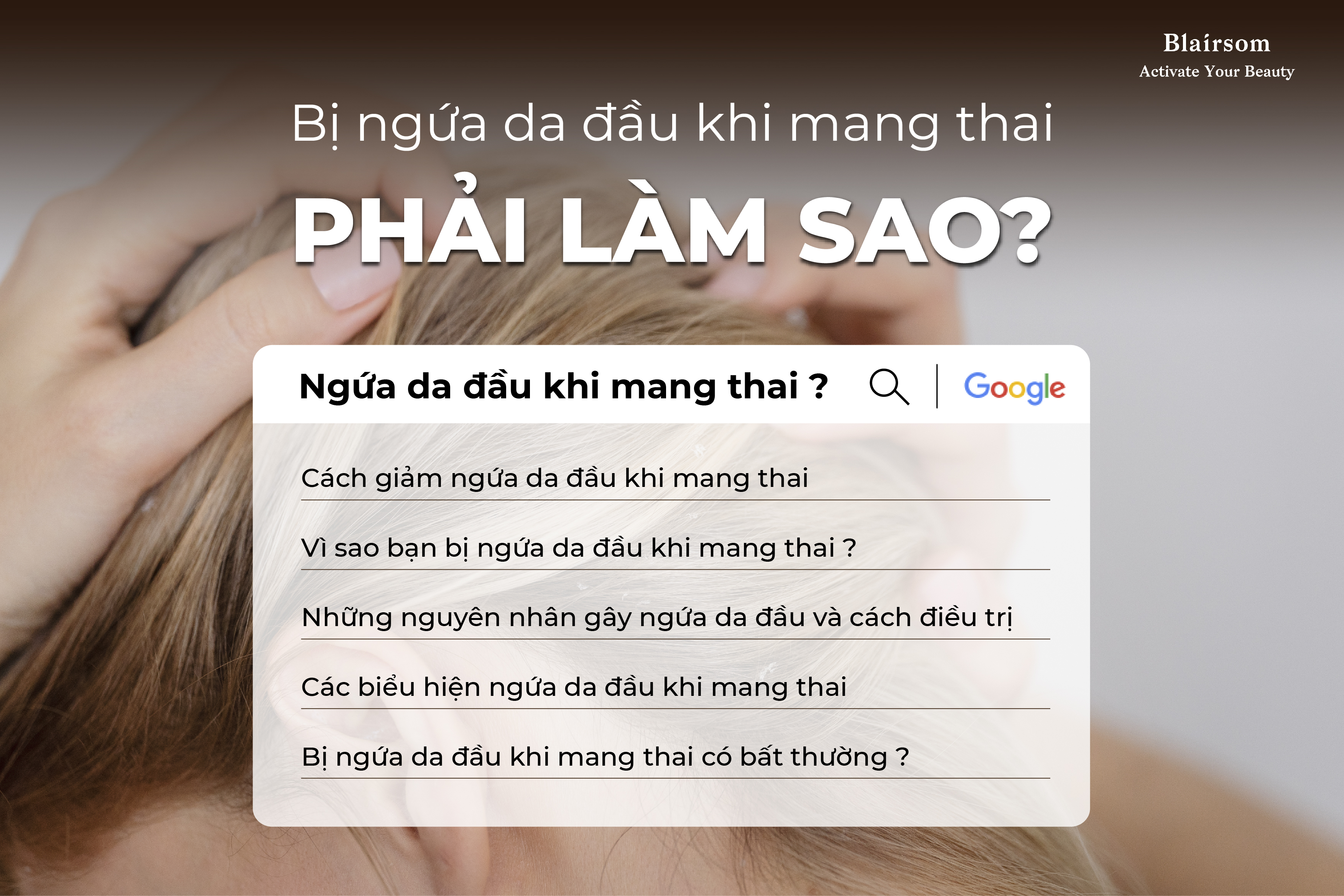 BỊ NGỨA DA ĐẦU KHI MANG THAI – PHẢI LÀM SAO?