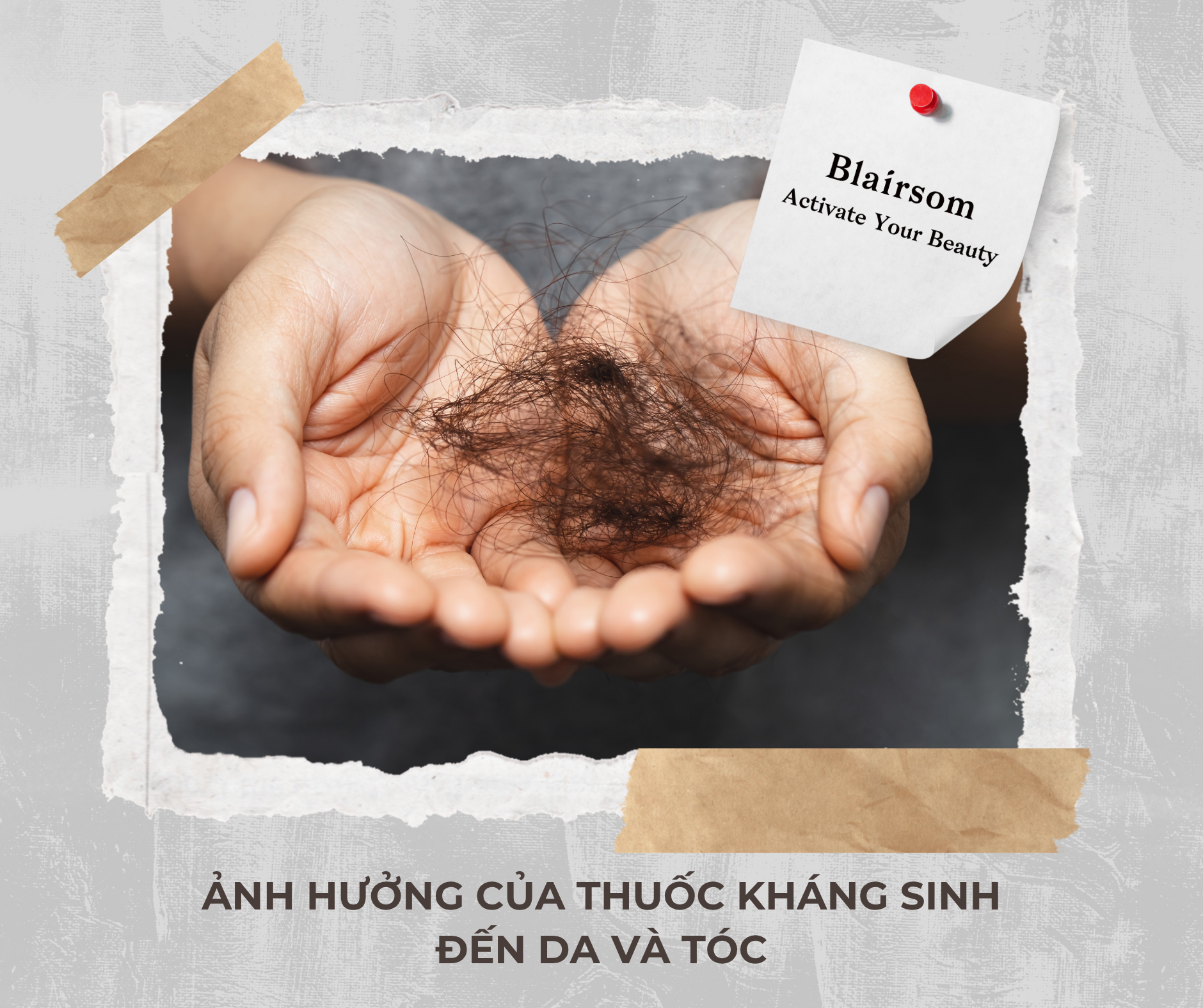 💥 ẢNH HƯỞNG CỦA THUỐC KHÁNG SINH ĐẾN DA VÀ TÓC