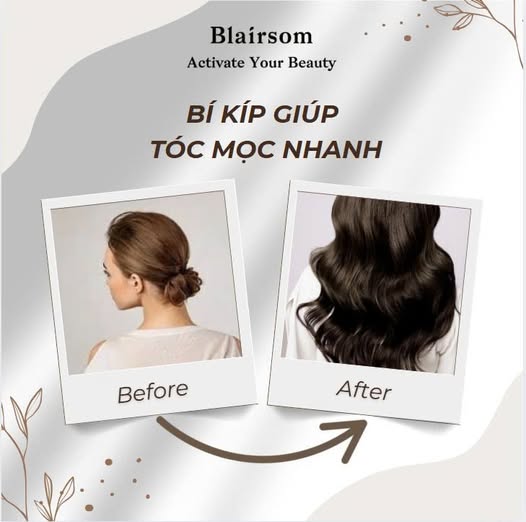 BÍ KÍP GIÚP TÓC MỌC NHANH