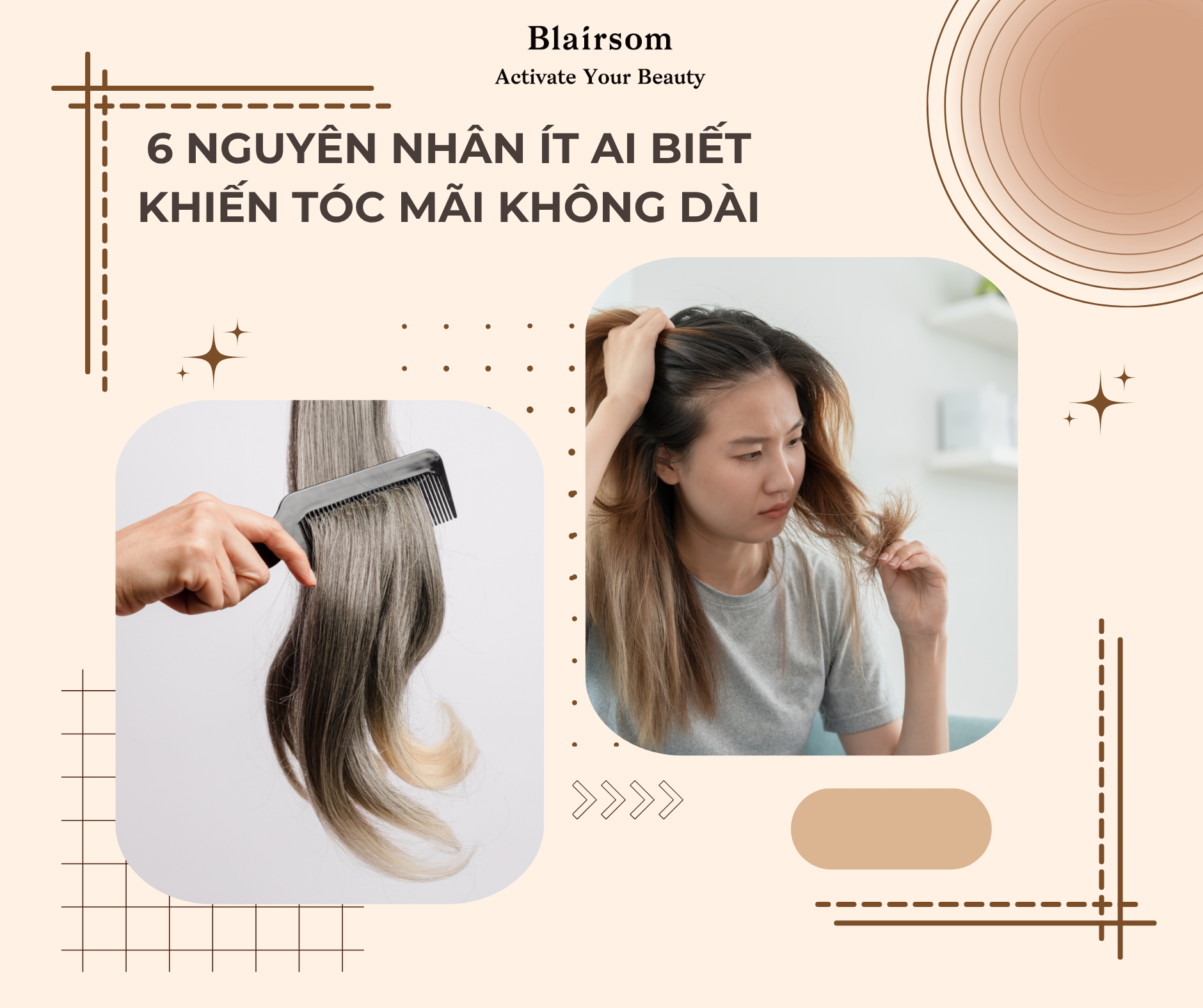 6 NGUYÊN NHÂN ÍT AI BIẾT KHIẾN TÓC MÃI KHÔNG DÀI